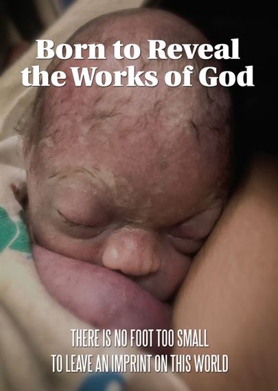 BORN TO REVEAL THE WORKS OF GOD (DVD)