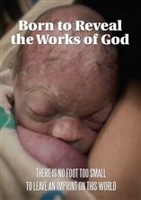BORN TO REVEAL THE WORKS OF GOD (DVD)